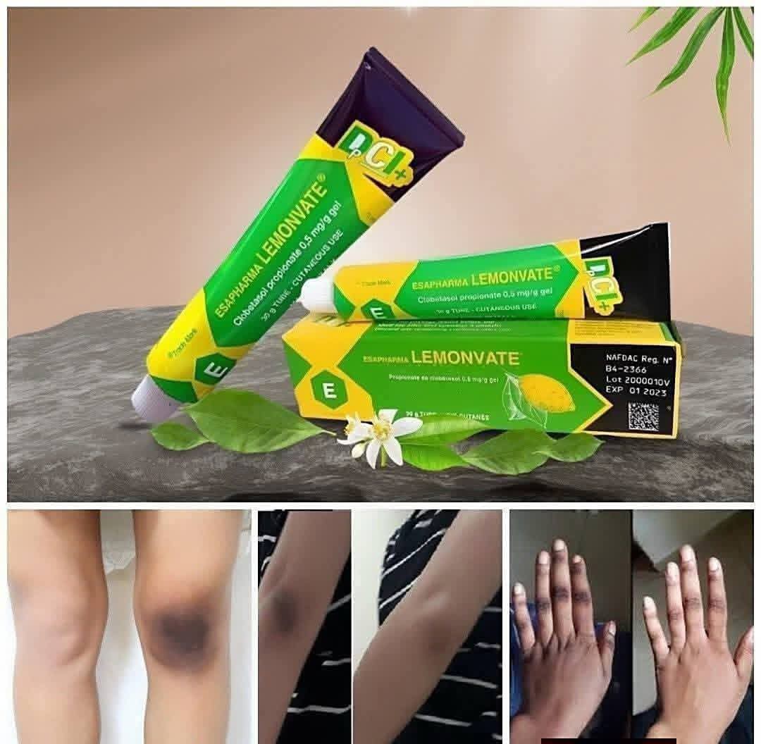 Lemonvate Cream